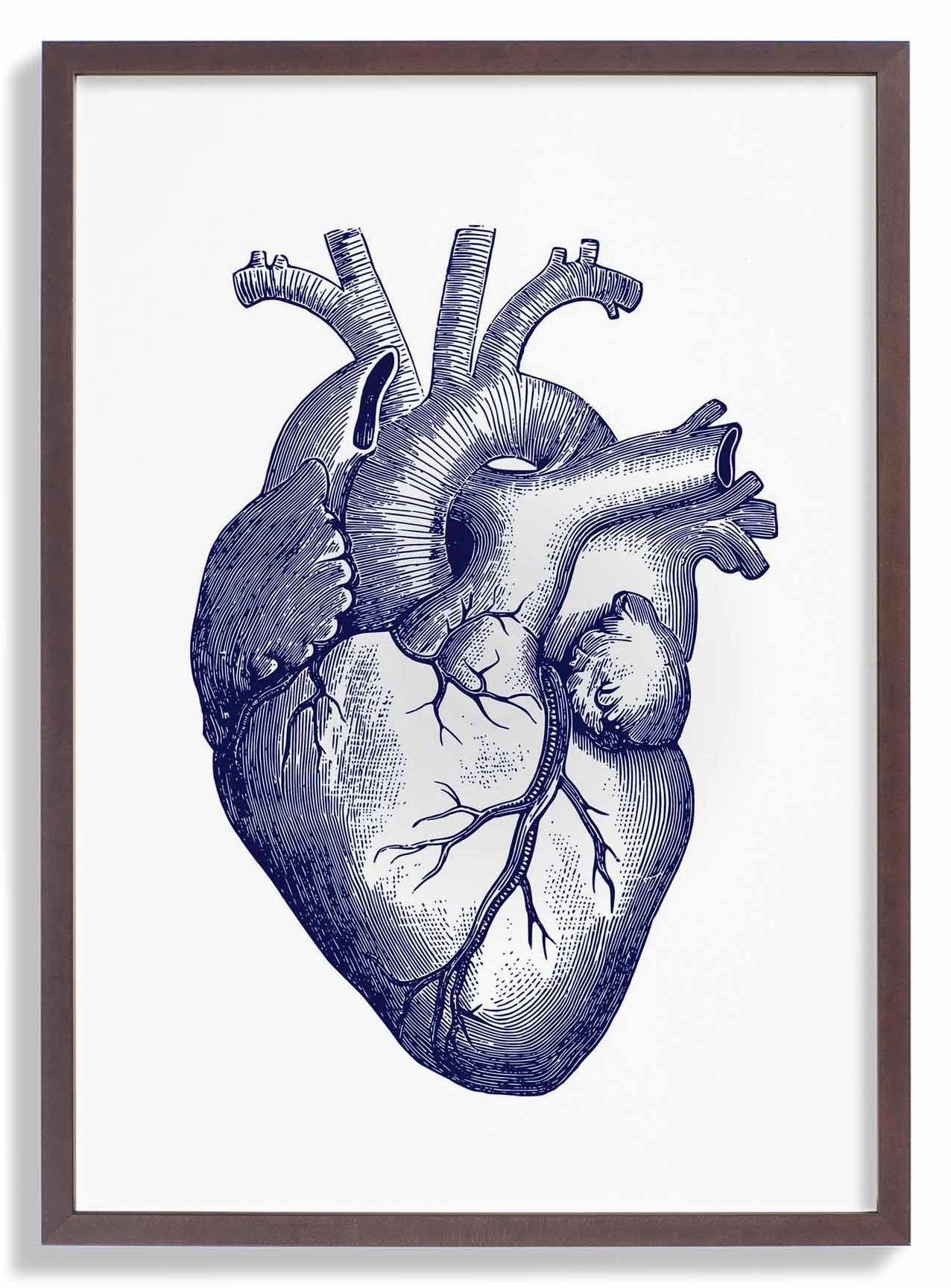 Blue Heart - Image 7